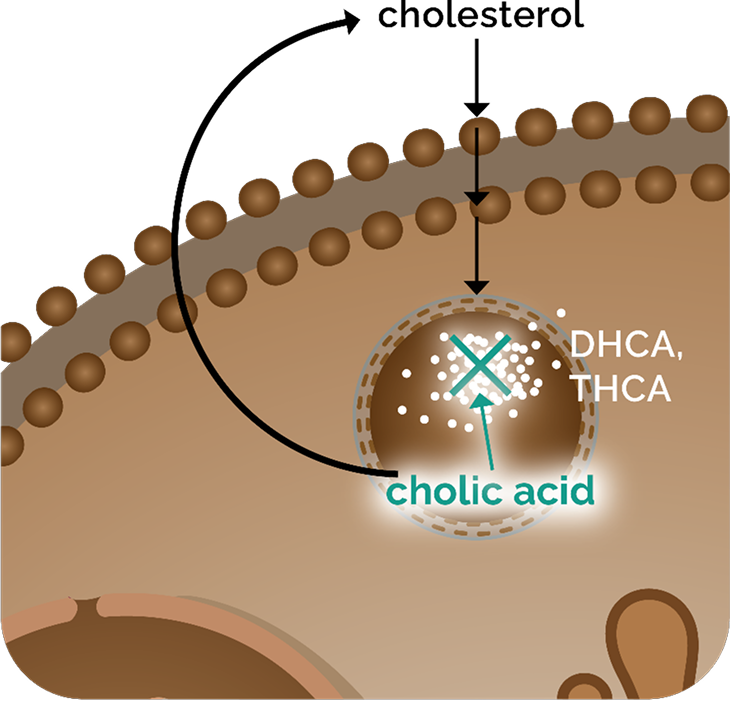 Cellular illustration showing how cholic acid (CHOLBAM) blocks the buildup of DHCA and THCA derived from cholesterol, helping restore bile acid homeostasis in PBD-ZSD hepatocytes